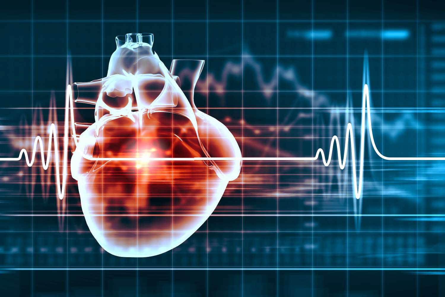 Maladies cardiovasculaires